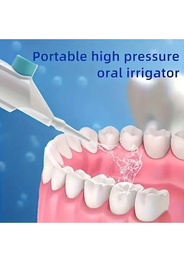 Willowhaven Beyaz Taşınabilir Manuel Yüksek Basınçlı Oral Irrigator - Diş Arası Su Diş İpi