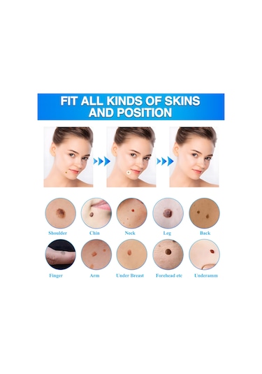 Vkemall Et Beni Ve Siğil Çıkarma Seti: Ağrısız, Güvenli Ve Etkili Çözüm