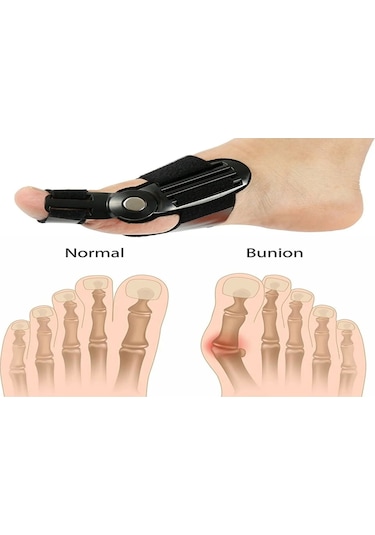 Benlife Makaralı Baş Parmak Kemik Düzeltici