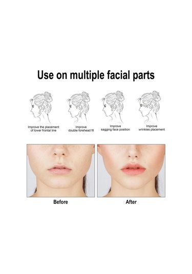 Youtek Eelhoe 60 Adet V Şekilli Su Geçirmez Yüz Germe Bandı - Cilt Dostu Esnek Yapışkan Bant