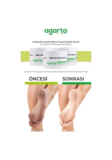 Agarta Ayak Ve Topuk Çatlak Bakım Kremi 100ml