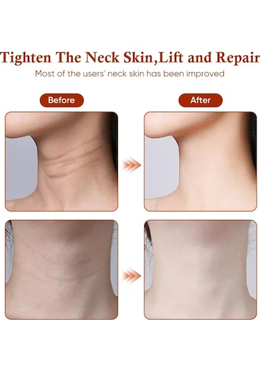 Jl Boyun Güzellik Cihazı Ems Mikro-akım Yüz Cilt Bakımı Masaj