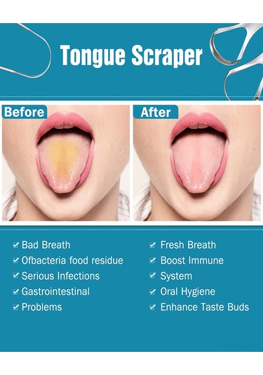 Mufunye Paslanmaz Çelik Dil Kazıyıcı Seti: Taze Nefes Ve Ağız Hijyeni İçin İdeal Çözüm