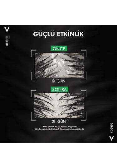 Vichy Dercos Anti-Dandruff Normal ve Yağlı Saçlar İçin Kepek Karşıtı Şampuan 390 ML