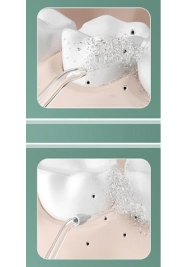 Lichen Ev Tipi Ağız Duşu, Taş Temizleyici, Diş Yıkama Makinesi,