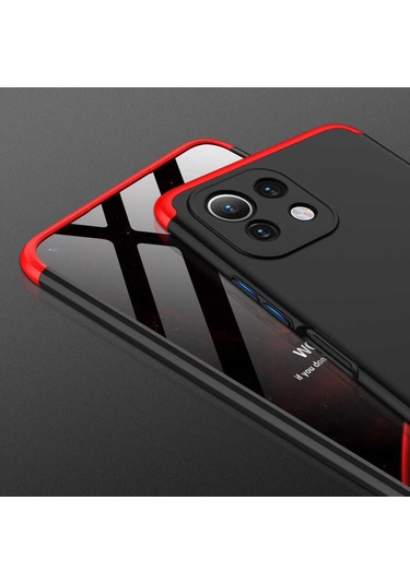 Xiaomi Mi 11 Lite Kılıf Zore Ays Full Koruma Kılıf