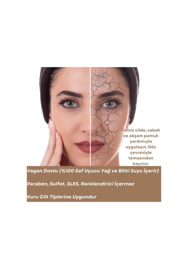 Skin Care Toner - Kuru Ciltler İçin Cilt Bakım Suyu