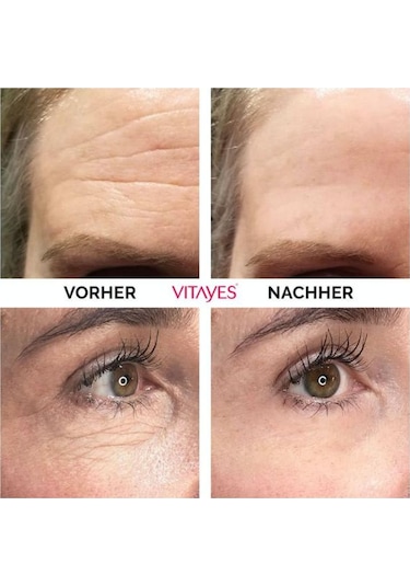 Vitayes Instant Ageback Anında Etkili Yüz Germe Kremi 15 ML