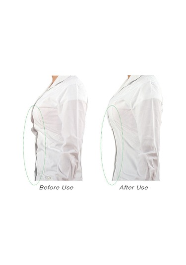 Samdoo 5m Transparent Medical Adhesive Kadın Giyim Kayma Engelleme Bandı - Gösterimsiz, İki Yönlü, Kuru Deri Uygun