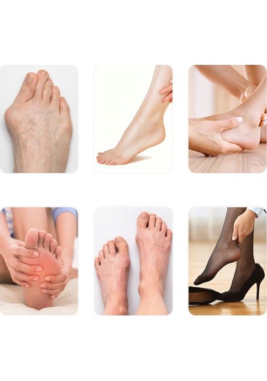 Akestoria Med Ayarlanabilir Cırtlı Baş Parmak Kemik Sönger Düzeltici Fc-053 Standart