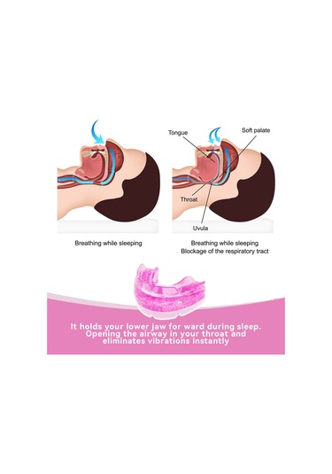 Vkemall Diş Gıcırdatmaya Karşı Saklama Kutusu İle Ayarlanabilir Anti Horlama Cihazı Ağız Pembe
