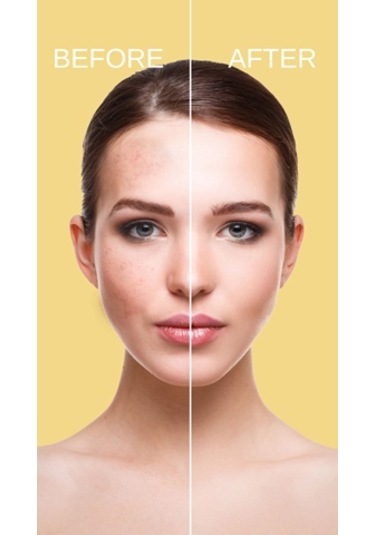 Cremika Çay Ağacı Yağı İçerikli Yüz Temizleme Jeli 400 ML