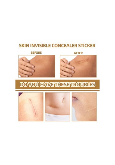 Hangfox 60 Adet Silikon Gizleme Yama Seti - Doğal Görünüm, Nefes Alıcı - Yara Izleri, Doğuş Lekeleri Ve Benekler İçin Uygun