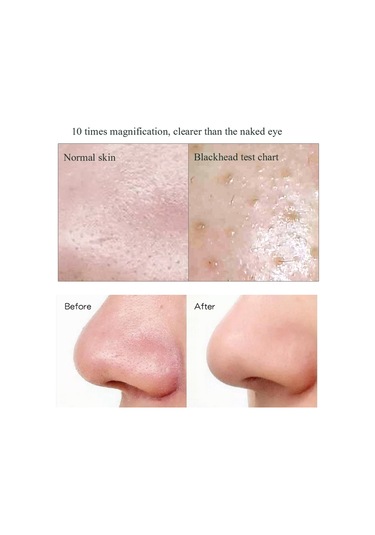 Sones Siyah Nokta Elektrikli Gözenek Temizleme Makinesi Temiz Yüz Ekipmanı, Stil: Tabansız