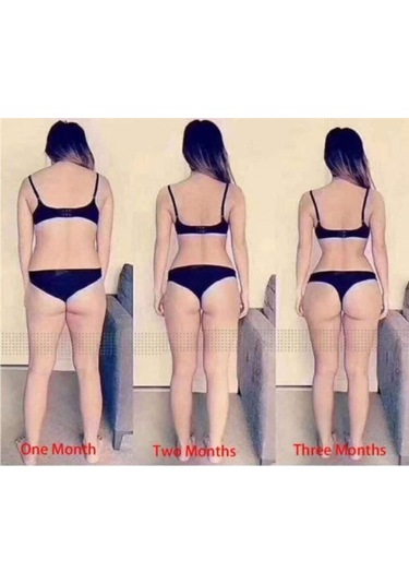 Selülit Önleyici Giderici Zayıflama Korsesi Kalça Kaldırma Korsesi