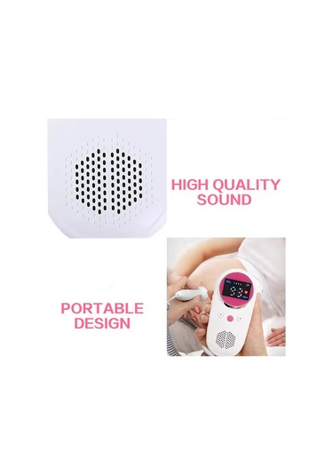 Kangvka Evde Kullanıma Uygun Pembe Fetal Kalp Monitörü - Yüksek Hassasiyetli Doppler Teknolojisi, Dış Ses Ve Kulaklık Desteği, Lcd Ekranlı Pil Yok
