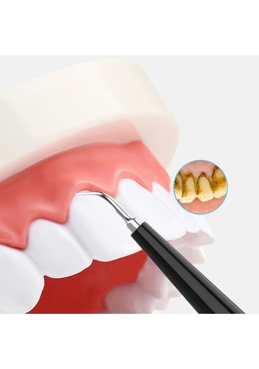 Jyq-023 Ağız Diş Temizleme Ve Bakım Aracı Ev Elektrikli Diş Aleti, Sarı Diş Ve Tütün Lekelerini Çıkarmak İçin Siyah + Diş Yüzeyi Temizleme Kafası