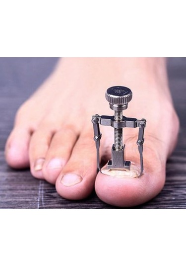 Ayak Tırnak Çıkartıcı Metal Tırnak Batık Mengenesi Aleti Aparatı