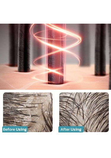 Leezsing Elektrikli Yağ Aplikatörü Tarak Saç Derisi Bakım Masaj Başlığı Rahatlatıcı Aletler Beyaz