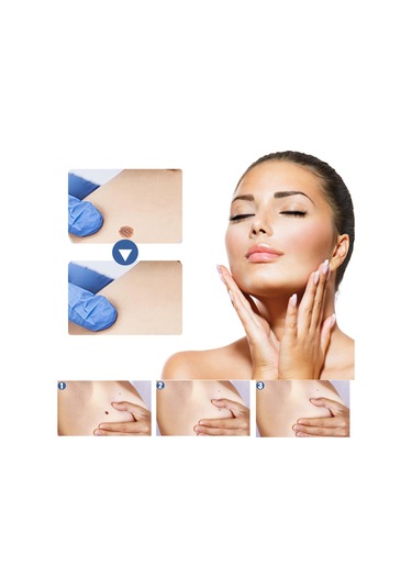 Vkemall Eelhoe Doğal İçerikli Siğil Yapışkanları 144 Adet, Ağrısız Cilt Temizliği, Her Cilt Tipi İçin Uygun, Su Geçirmez Ve Nefes Alabilir.