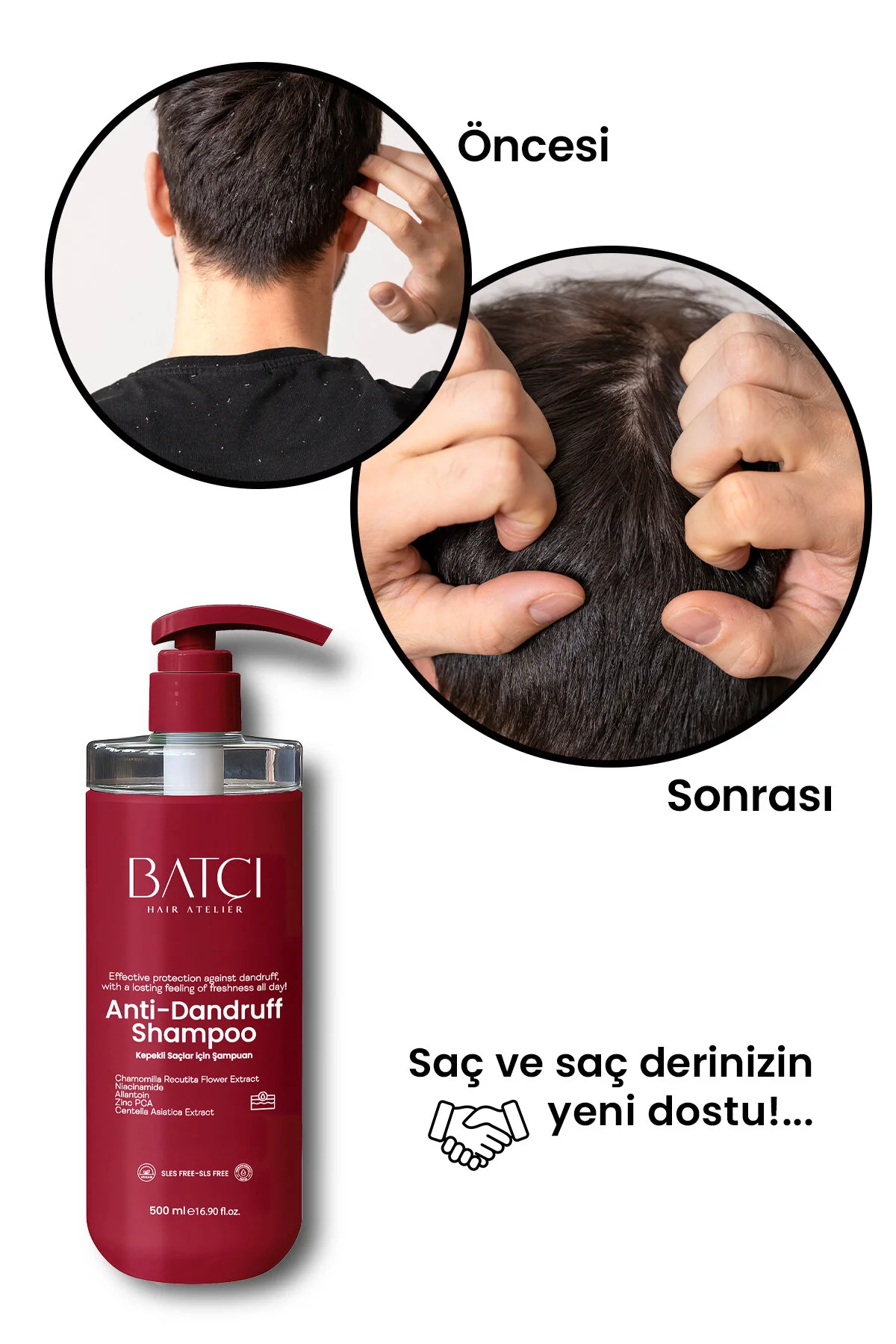 Kepek Önleyici Şampuan Ve Pullanma Karşıtı, Yatıştırıcı Şampuan 500 Ml Tüm Saçlar