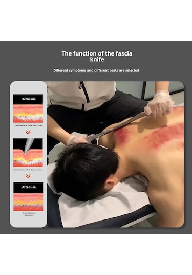 Springsun Stainless Steel A Tipi Köpekbalığı Bıçağı İle Kas Gerginliği Serbest Bırakma, Fasya Serbest Bırakma, Toplumcu Kas Bakımı 5'li Set Kumaş Çanta İle Diğer