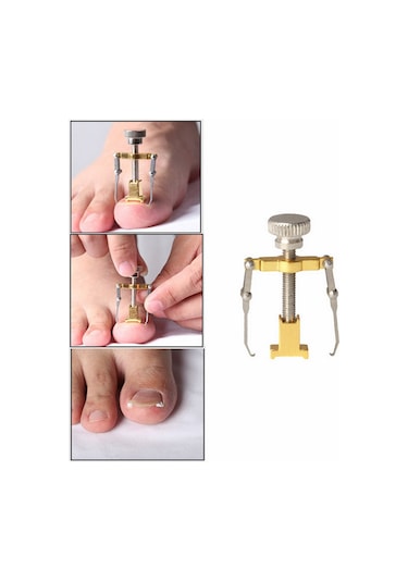 Qingmipy Altıparmak Tırnağı Düzeltme Aracı - İçbükey Tırnak Sorunu Çözücü - Paslanmaz Çelik Altın