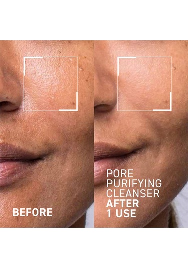 Dr.brandt Pores No More Pore Purifying Cleanser 105ml Cilt Temizleyici