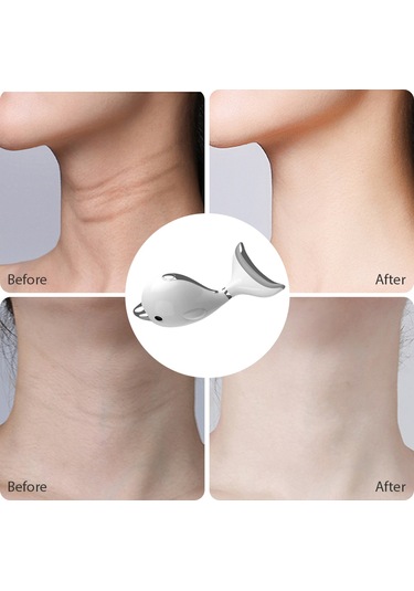 Hangfox Yenilenebilir Pil Liçli Boyun Ve Yüz Gerginleştirici Cihazı - Cilt Bakımı Aleti, İç Çizgileri Azaltır, Çift Alttan Dudak Azaltır Beyaz