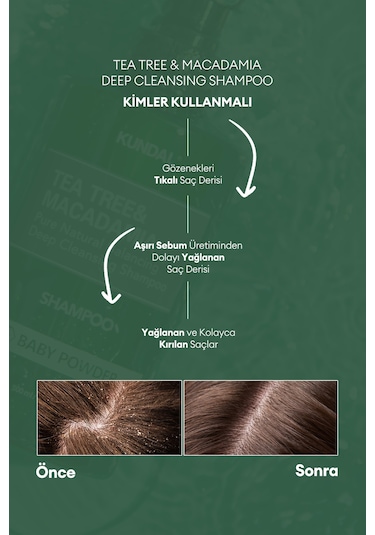 Sorunlu Saç Derisine Özel Şampuan Kundal Tea Tree & Macadamia Deep Cleansing Shampoo Baby Powder