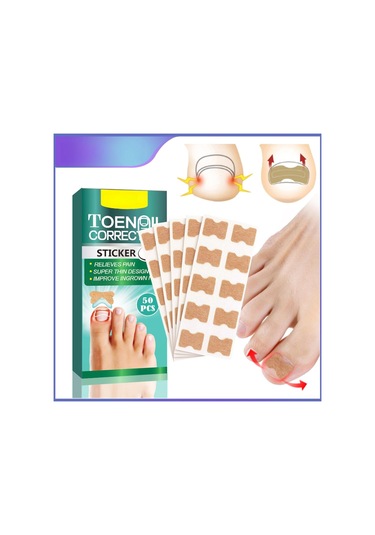 Yifomall 50 Adet Oýnaxan Tırnak Tamiri Seti - Ayak Tırnağı Yumuşatıcı Bandajı, Profesyonel Tırnak Düzeltme Yapistırıcısı