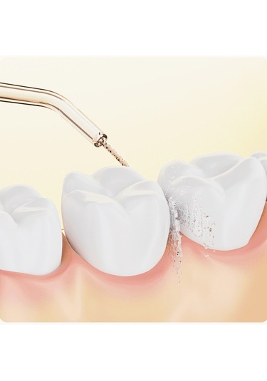 Lichen Diş Taşlarını Çıkarmak İçin Elektrikli Taşınabilir Su İpi