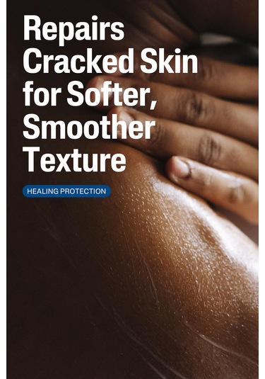 Cetaphil Çatlamış Cilt Onarıcı Losyon 473ml