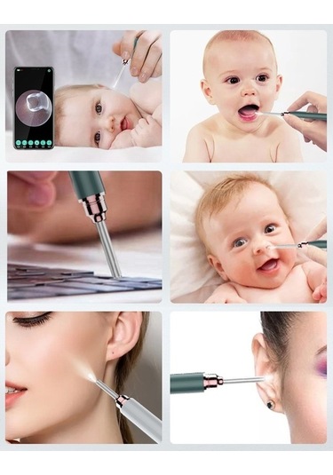 Flybuy Kablosuz Kulak Endoskop - Doktor Kontrolü İçin, Wifi Hd, Usb Şarjlı