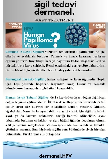 Dermanel Siğil Seti