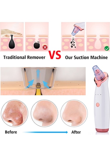 Hangfox Evcil Cilt Bakımı Elektrikli Siyah Nokta Çıkarıcı - 3 Seviye Ayarlı, 5 Emme Ucu Ve 5'li İğne Seti İle Derin Pore Temizleyici Cilt Bakımı Aleti