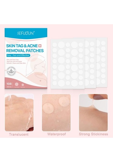 108 Adet Cilt Etiketi Akne Kaldırma Yamalar Ağrısız Pürüzsüz Temiz Temizle Cilt Hızlı Sökücü Sivilce Siğil Ana Yama Tedavisi Korur