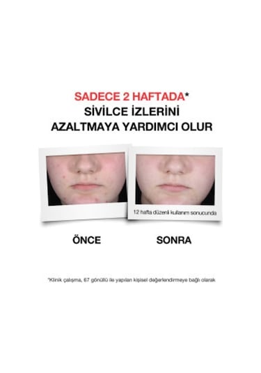 Neutrogena Sivilce Karşıtı Plus Temizleme Jeli 200 ML