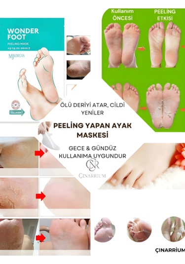 Ölü Deri Ve Çatlaklar Için Soyulabilen Ayak Peeling Maskesi 50ml Wonder Foot Peeling Maskesi