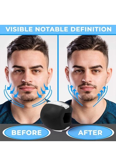 Erkekler Ve Kadınlar İçin 2'li Jawline Şekillendirici Paket - Çift Çeneyi Azaltır - 1 Pc - Mc Çok Renkli