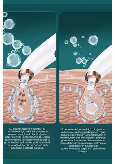 Neutron NTL-BR-06H Vakumlu Ultrasonik Siyah Nokta Temizleme Aleti