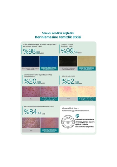 Gözenekleri Temizleyen Köpük Goodal Houttuynia Cordata Hyaluron Soothing Pore Cleansing Foam