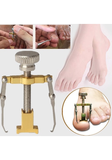 Ecoform Paslanmaz Çelik Batık Tırnak Çıkartma Aparatı Sarı