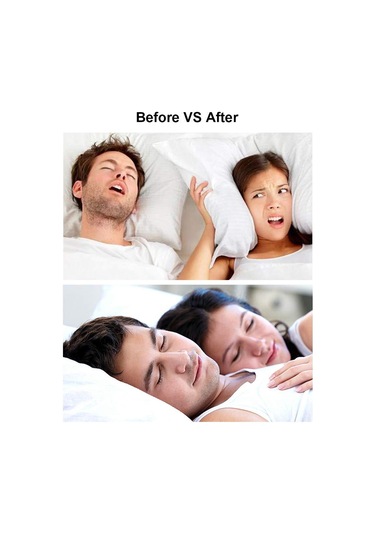 Lemestar Nefes Akışını Artıran Gece Uyku Konforu Burun Açıcı, Dört Farklı Boy S+m+l+xl Medikal Malzeme Reusable Snore Reducer