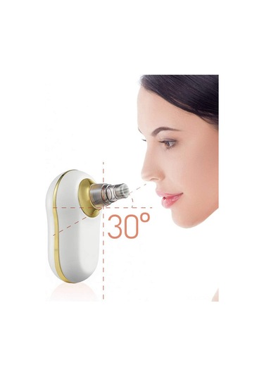 Samdoo Beyaz Elektrikli Siyah Nokta Çıkarıcı - 5 Farklı Prob Ve 3 Güç Modu İle Gözenek Temizleme, Ani Tüketim Ve Cilt Yenileme Cihazı Çok Renkli