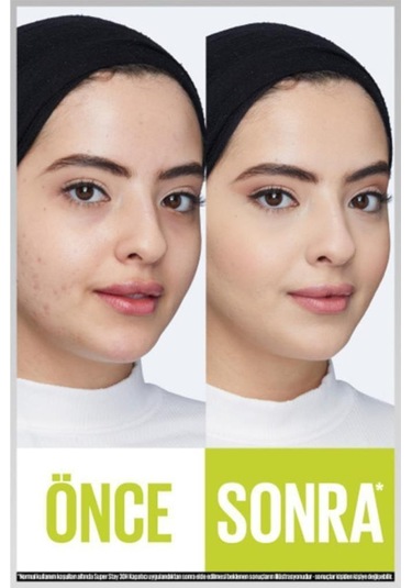 Maybelline  New York Super Stay 30H Kapatıcı 20 Sand