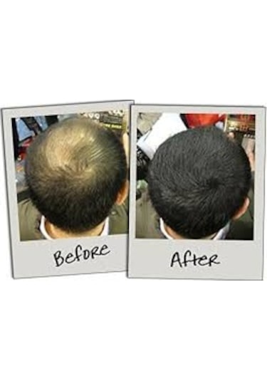 Sevich Koyu Kahve Saç Fiberi Keratin Saç Tozu 100 G