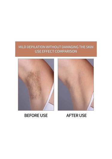 Nano Epilasyon Taşı, Kristal Epilasyon Cihazı, Kristal Epilasyon