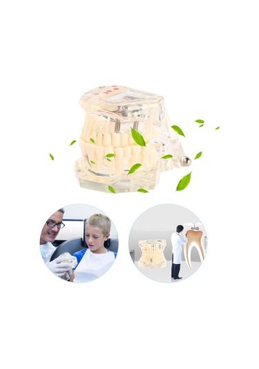 Samdoo Diş Sağlığı Eğitim Modeli: Şeffaf, Ayrılabilir Mandibula Ve Maksila - Diş Yapısı Ve İmplantasyon Öğretimi Çok Renkli