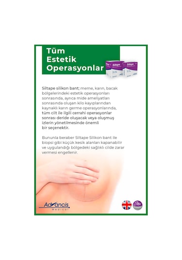 Advancis Medical UK Siltape Soft Silikon Yara İzi Dikiş İzi Sezaryen Yanık Estetik Bant 2 CM x 3 M